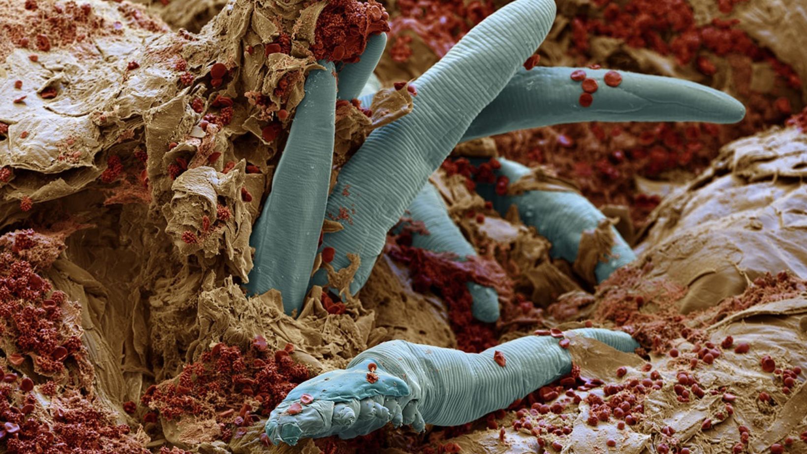 Demodex Mites: The Microscopic Creatures Living on Your Skin