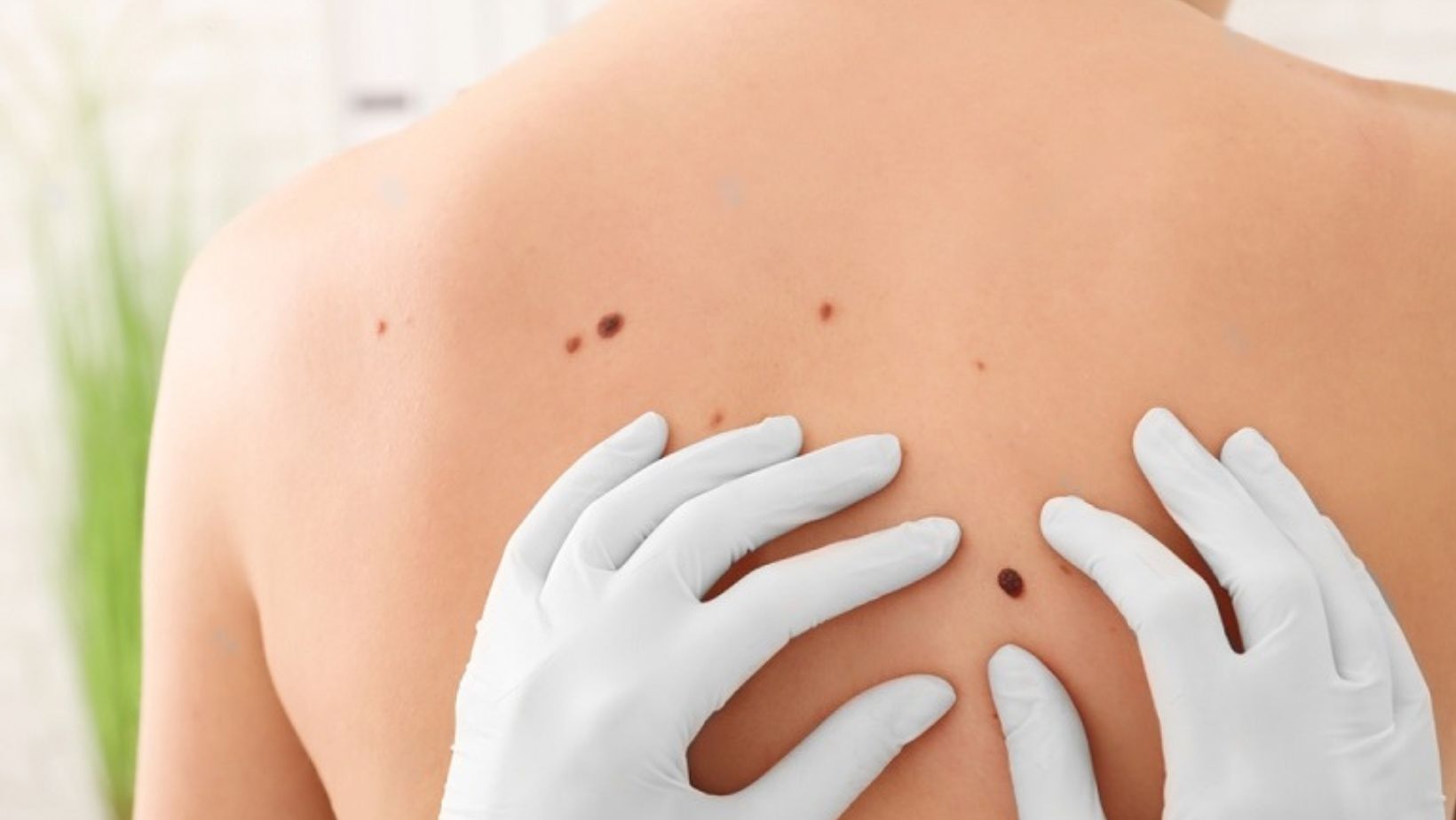 - True Spring Nutrition The Skin You're In: Why Your Body's Largest Organ Deserves Extra Care