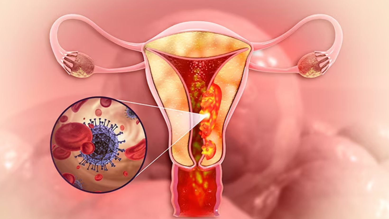 New Immunotherapy Shows Promise in Preventing Skin Cancer, Lasting Benefits for Five Years