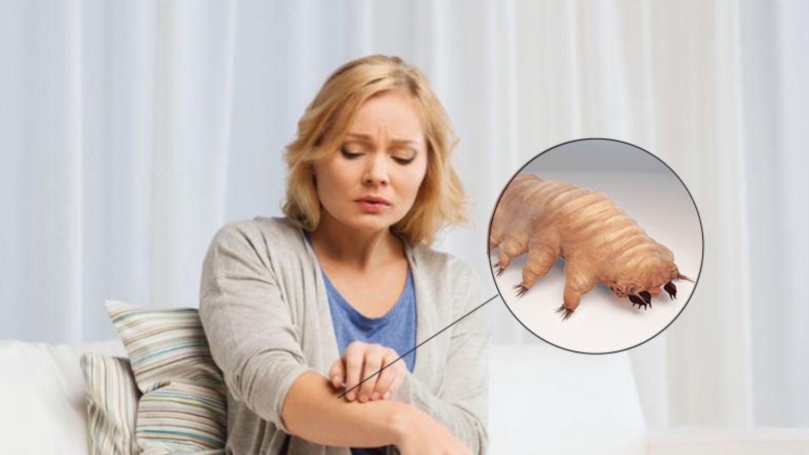 Demodex Mites: The Microscopic Creatures Living on Your Skin