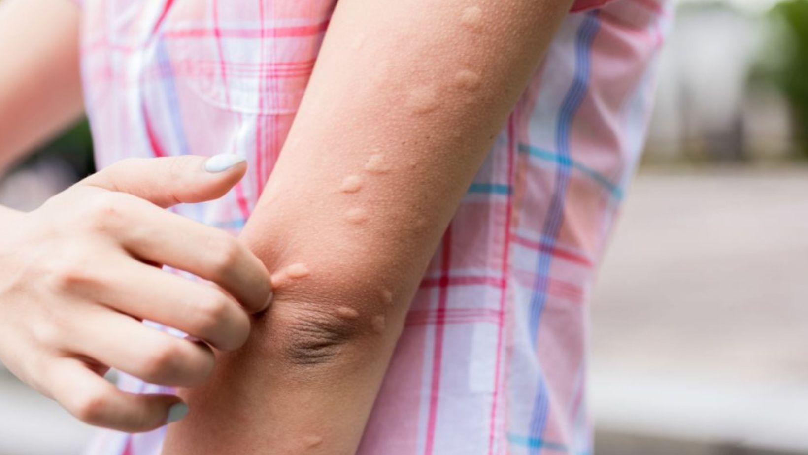 - True Spring Nutrition Australian Aboriginal Children See Drastic Reduction in Skin Infections Thanks to Community-Driven Program