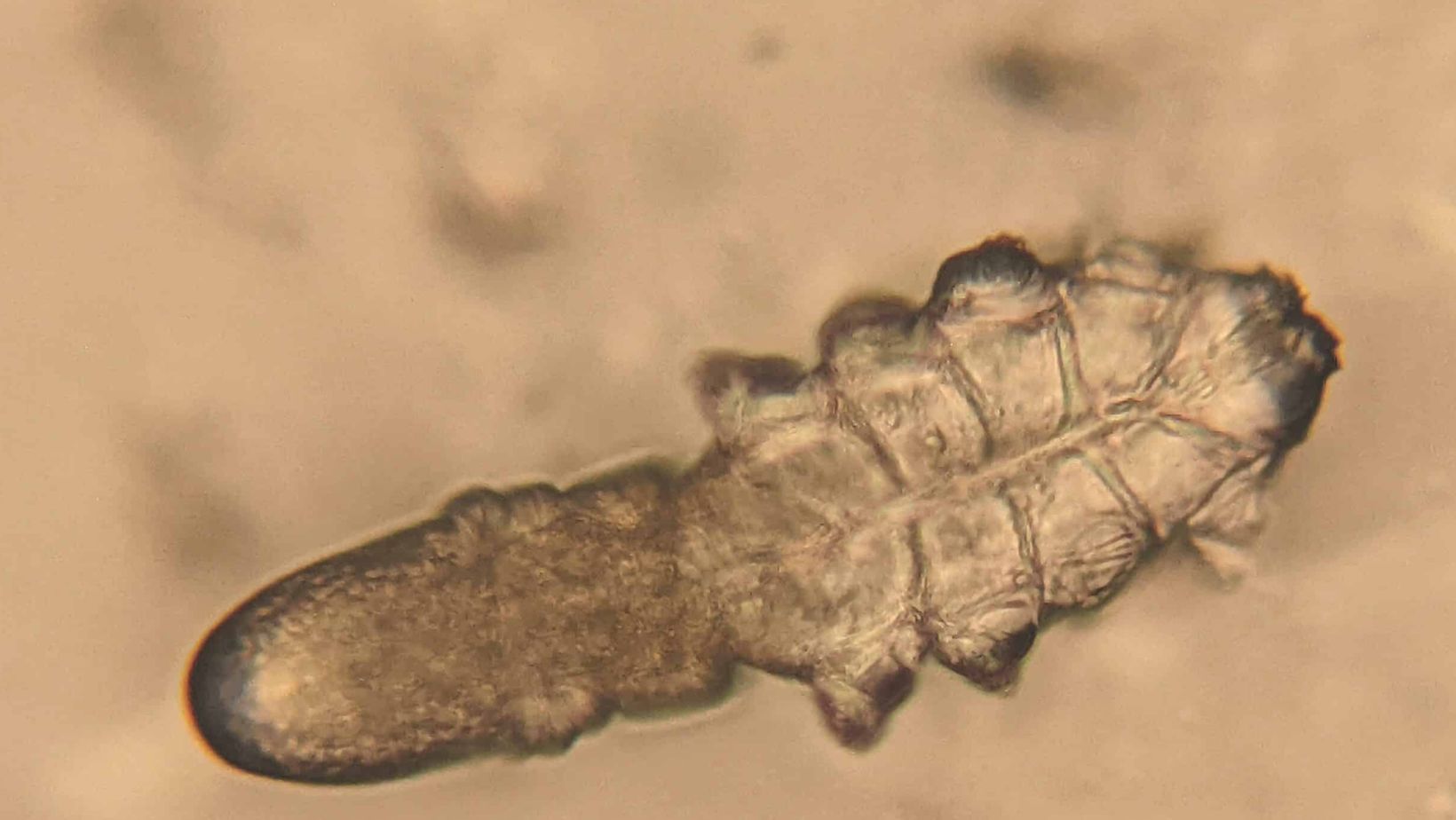 Demodex Mites: The Microscopic Creatures Living on Your Skin