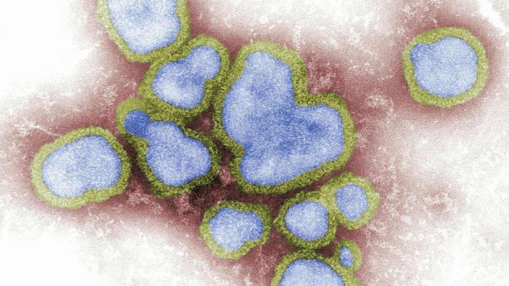 Flu Infections
