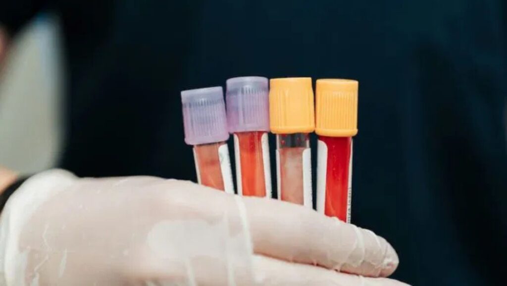 Untitled design 17 - True Spring Nutrition Blood Test