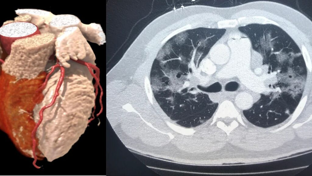 Untitled design 34 - True Spring Nutrition Heart Disease
