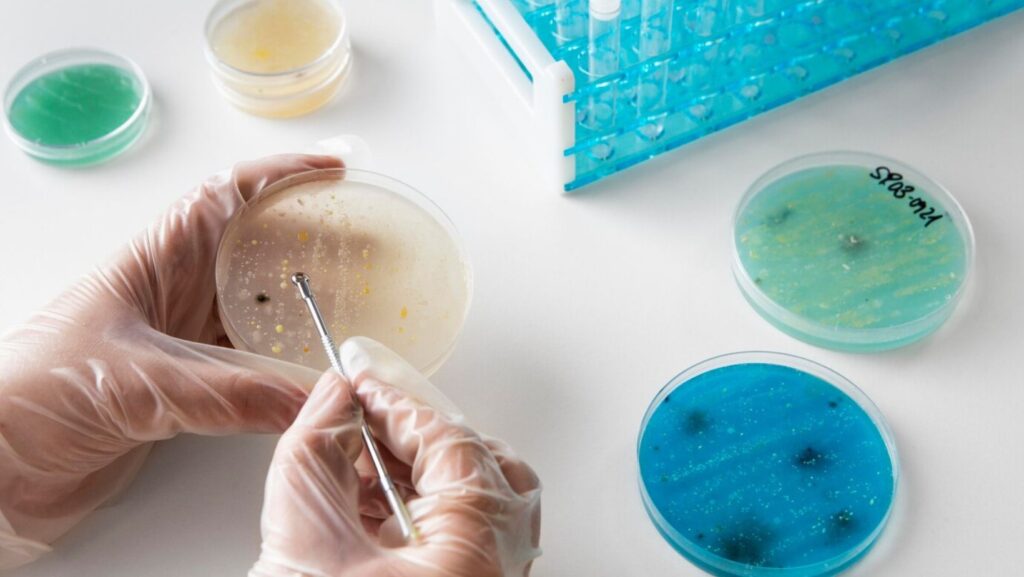 Flu Infections - True Spring Nutrition Flu Infections